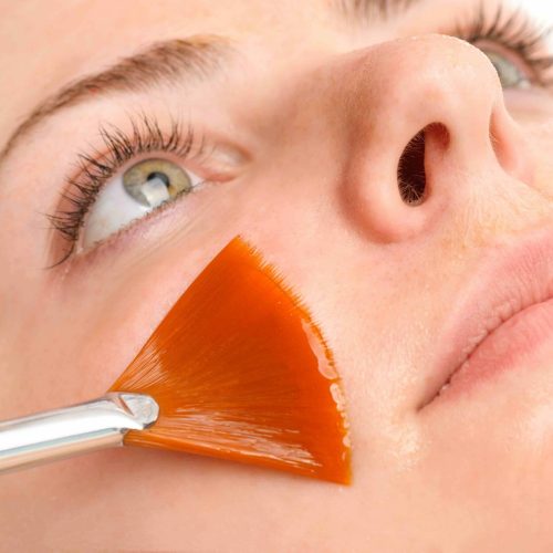 Swiss Facial