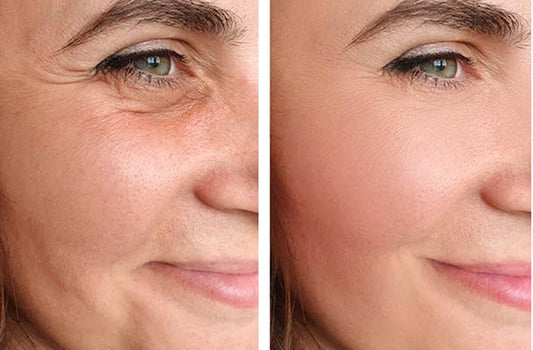 Face Lift Facial