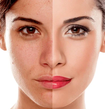 Collagen & DNA Treatment