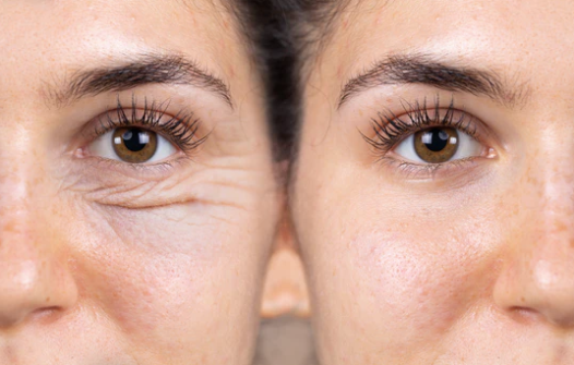 Eye Contour Detox