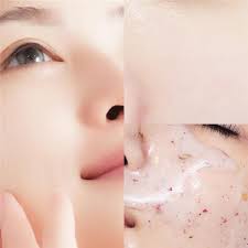 Natural Flora Therapy